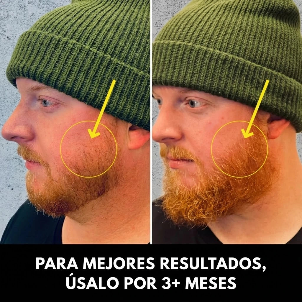 Adiós a los Huecos: Activa, Nutre y Crece